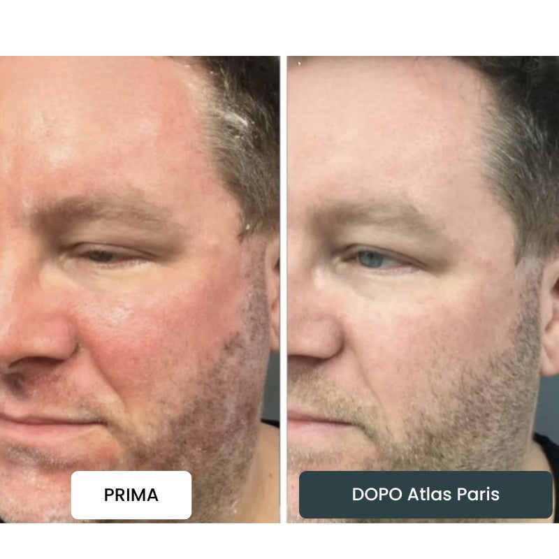 Crema Atlas Paris® ⎜ Per un Cuoio Capelluto e una Pelle Morbidi e Leniti