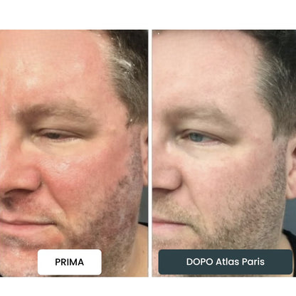 Crema Atlas Paris® ⎜ Per un Cuoio Capelluto e una Pelle Morbidi e Leniti