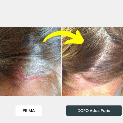 Crema Atlas Paris® ⎜ Per un Cuoio Capelluto e una Pelle Morbidi e Leniti