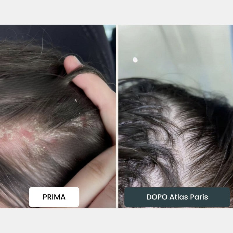 Crema Atlas Paris® ⎜ Per un Cuoio Capelluto e una Pelle Morbidi e Leniti