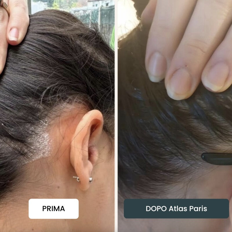 Crema Atlas Paris® ⎜ Per un Cuoio Capelluto e una Pelle Morbidi e Leniti